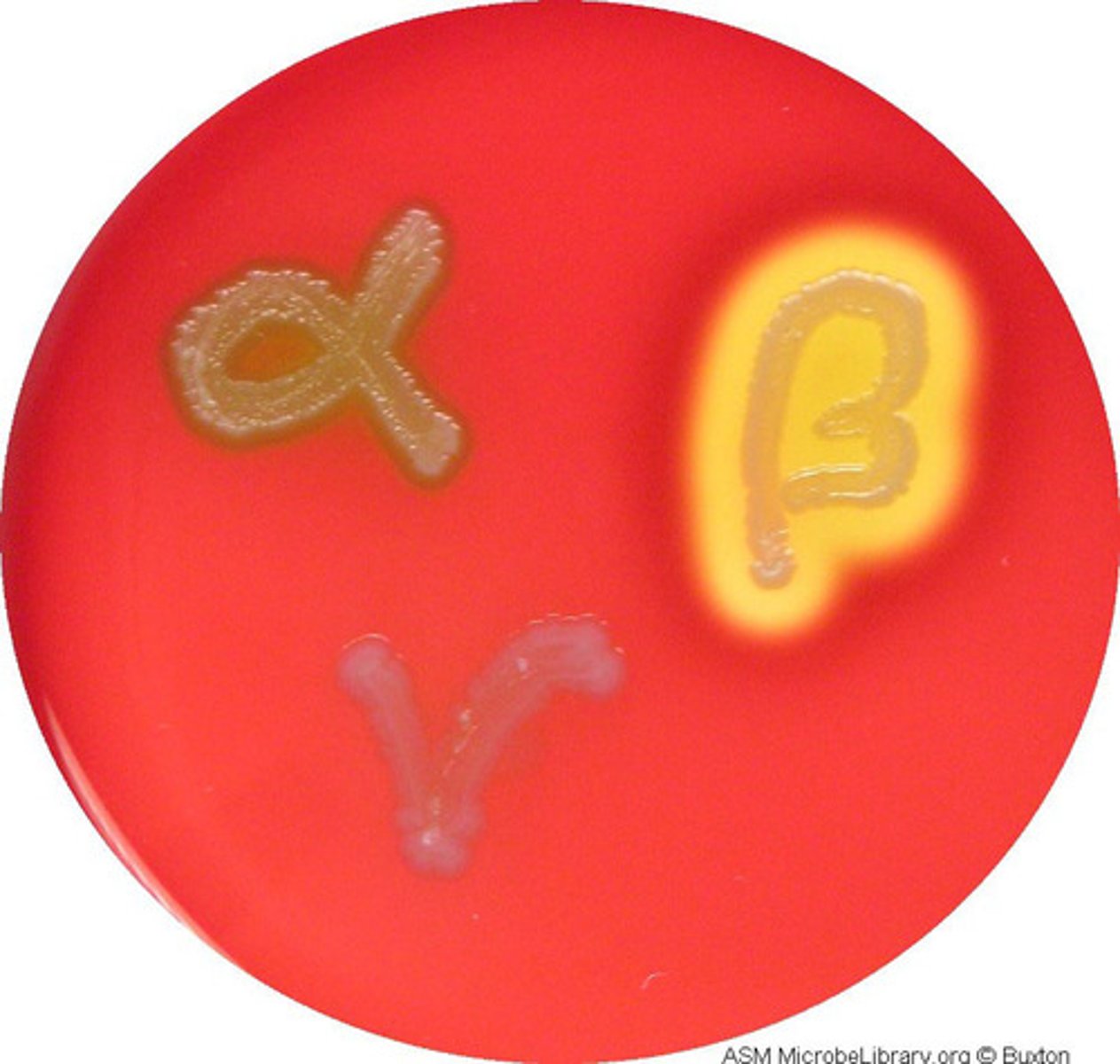 <p>Appearence</p><p>- Alpha: Greenish grey or brownish discoloration</p><p>- Beta: Clear ( around the colonies)</p><p>-</p>