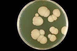 <p>What is SAB and what is it used for?</p>