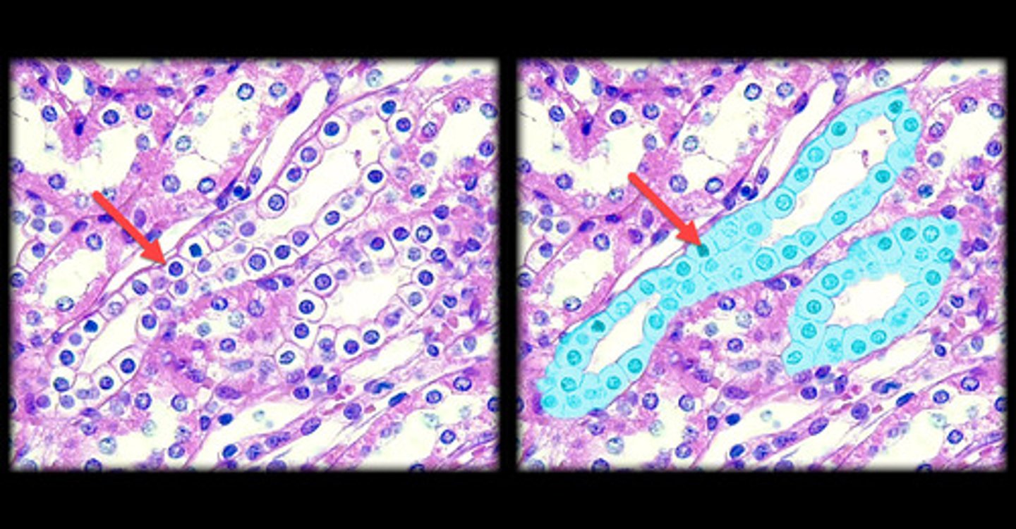 <p>- Single layer of cube-shaped cells.</p><p>- Nuclei are round and centrally located.</p><p>- Under the microscope, it appears as a neat row of box-like cells.</p><p>- Commonly lines glands and ducts, such as kidney tubules and the thyroid.</p>