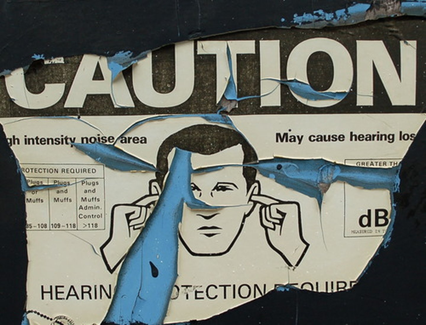 <p>Hearing loss caused by damage to the cochlea's receptor cells or to the auditory nerves; also called nerve deafness.</p>