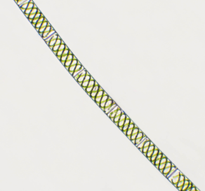 <p><span>coiled, spiral-shaped </span><strong>chloroplasts</strong><span>. Reproduction occurs both asexually through fragmentation and sexually, via a process called </span><strong>conjugation</strong></p>