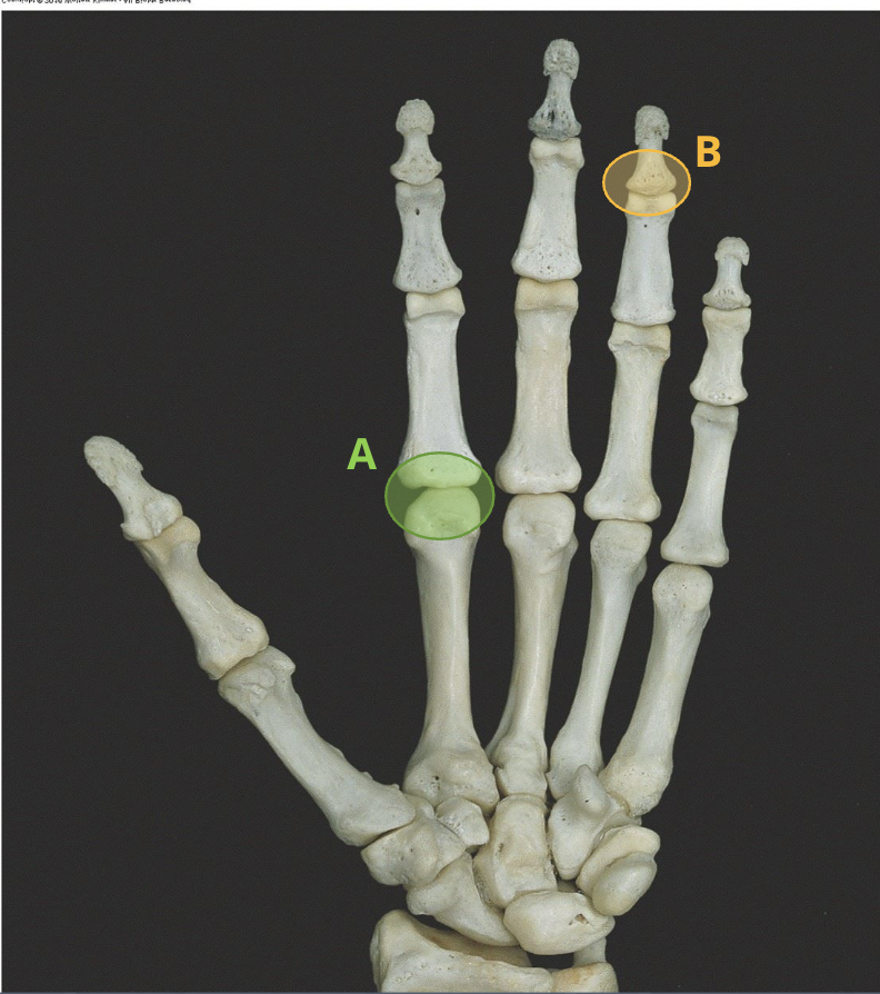 <p>A- ﻿﻿﻿﻿What is the classification of this joint?</p><p>B-﻿﻿﻿﻿If you are unable to flex this specific joint, what nerve might be damaged?</p>