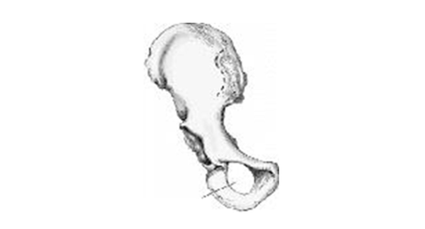 <p>The area of anatomy indicated on the figure above is the:</p><p>pubis</p><p>ischium</p><p>acetabulum</p><p>obturator foramen</p>