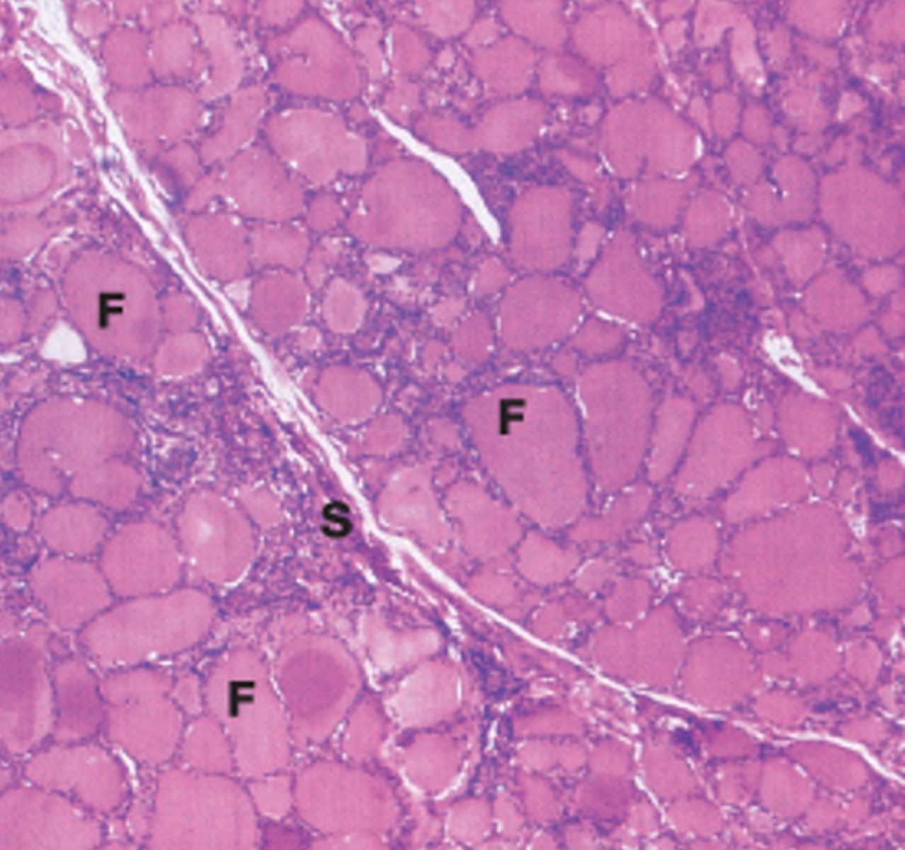 <p>What structure:</p><p>-parenchyma composed of rounded follicles line by simple cuboidal/columnar epithelium , containing gelatinous acidophilic colloid</p>