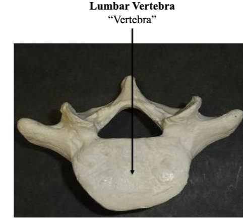 <p>Lumbar Vertebra </p>