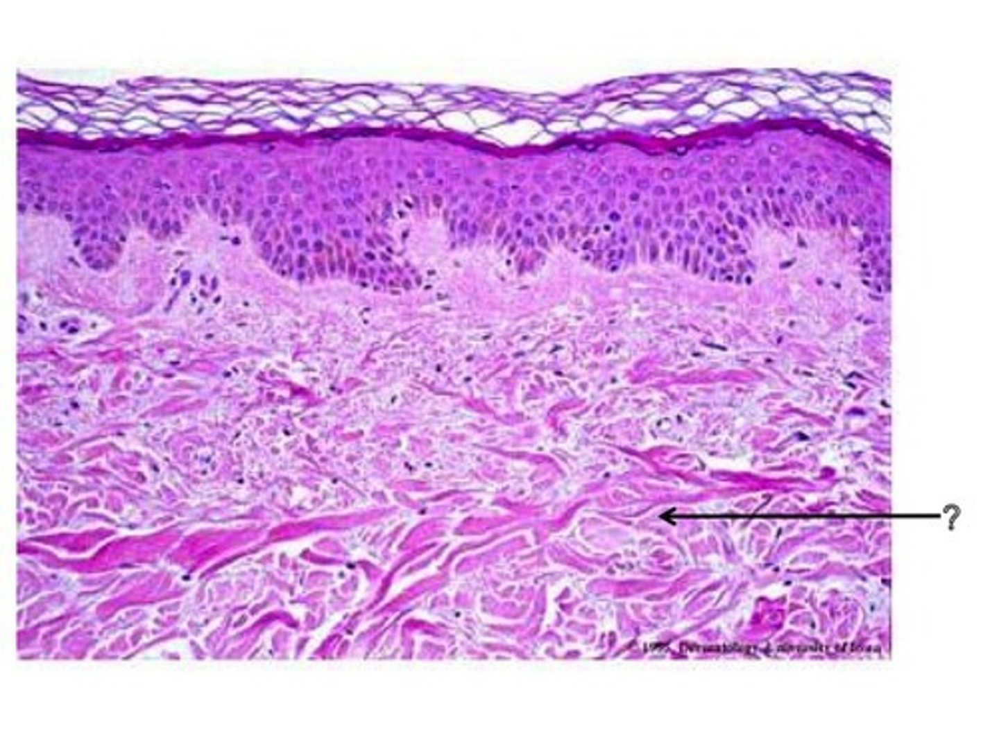 <p>What layer is the arrow pointing to?</p>