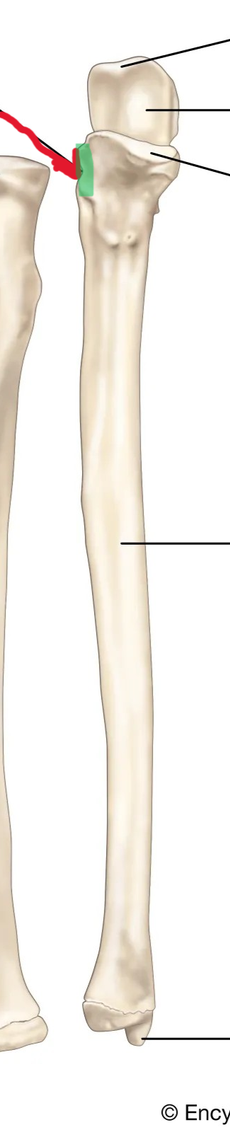 <p>What part of the ulna is this?</p>