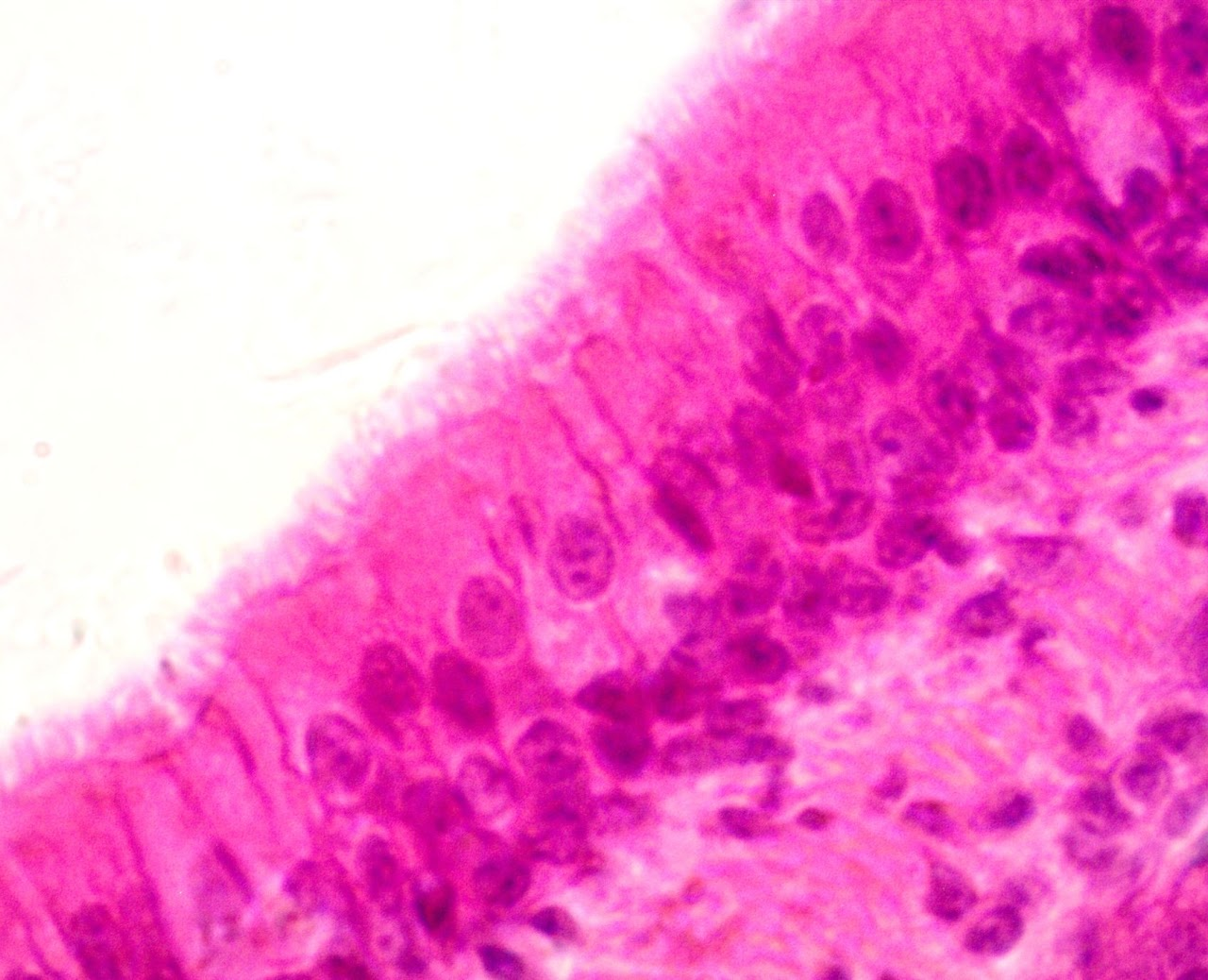 <p><span>Found in respiratory airways&nbsp;</span></p>