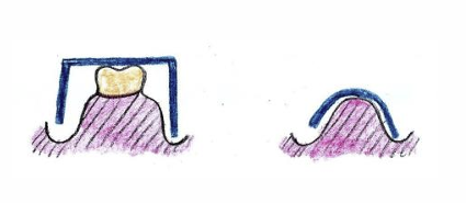 <p>Where would wax be added in this image?</p>