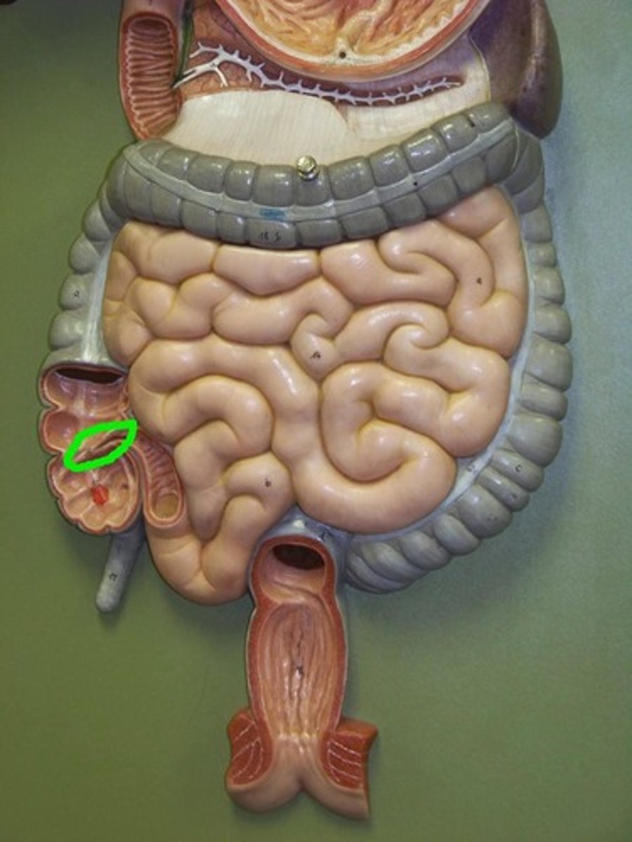 <p>Junction</p><p>- Between ileum and cecum</p><p>- TA will lay probe above the cecum to show</p>
