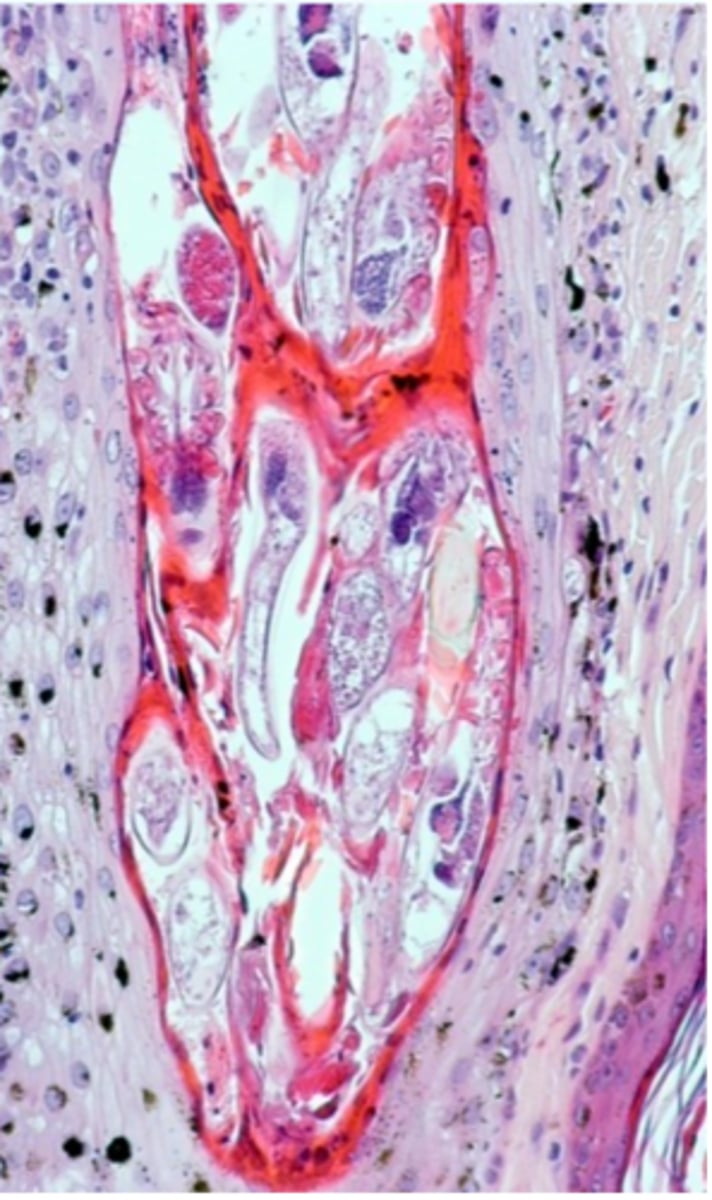 <p>Treatment efficacy is monitored monthly by clinical examination and skin scrapings;</p><p>• Treatment should be changed in dogs that show no clinical improvement or do not show reduction in mite counts after 1-2 month treatments</p><p>Time to cease the therapy</p><p>-&gt; No clinical signs and two negative scrapings one month apart</p><p>Dogs with generalized demodicosis and their parents should not breed</p>
