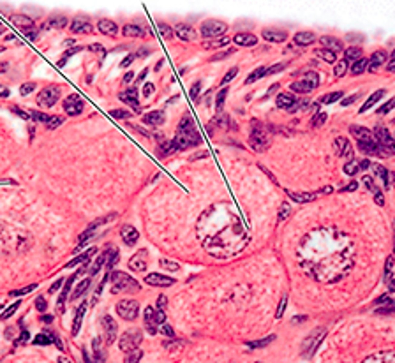 <p>ID the ovarian cell stage:</p>