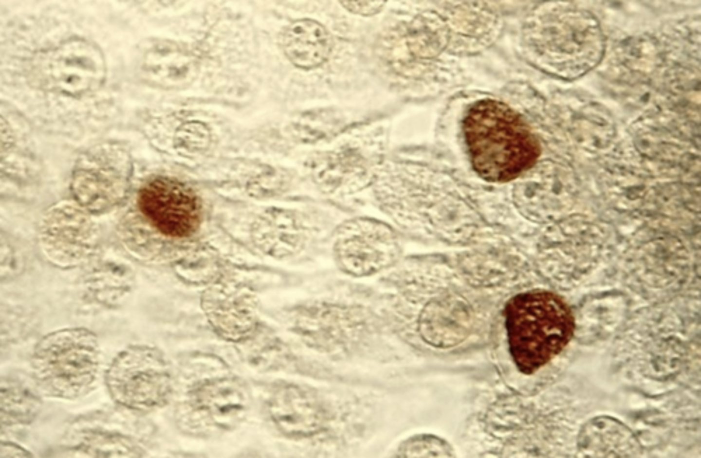 <p>inclusion</p><p>inclusions</p><p>glycogen</p>