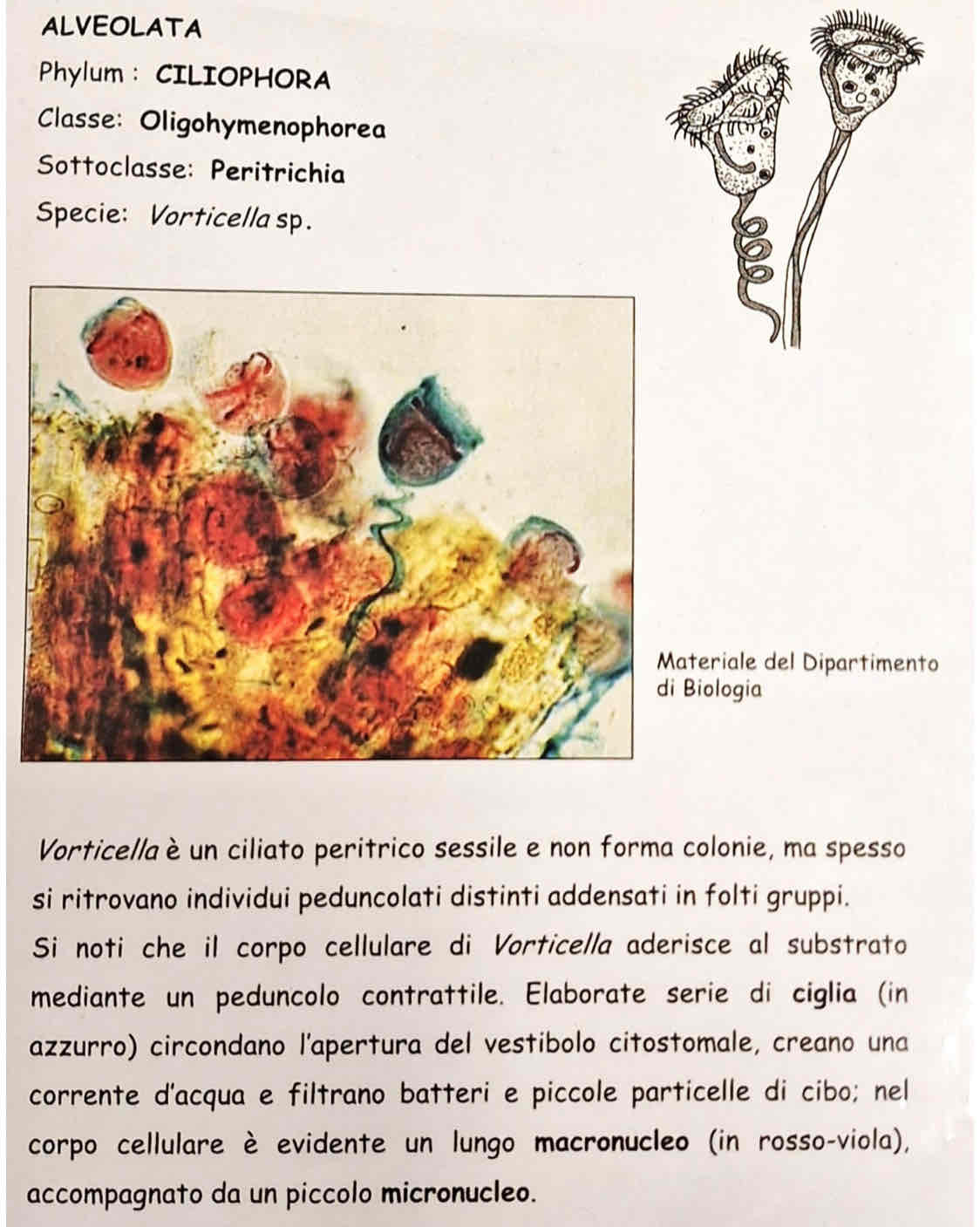 <p><em>Vorticella sp.</em></p>