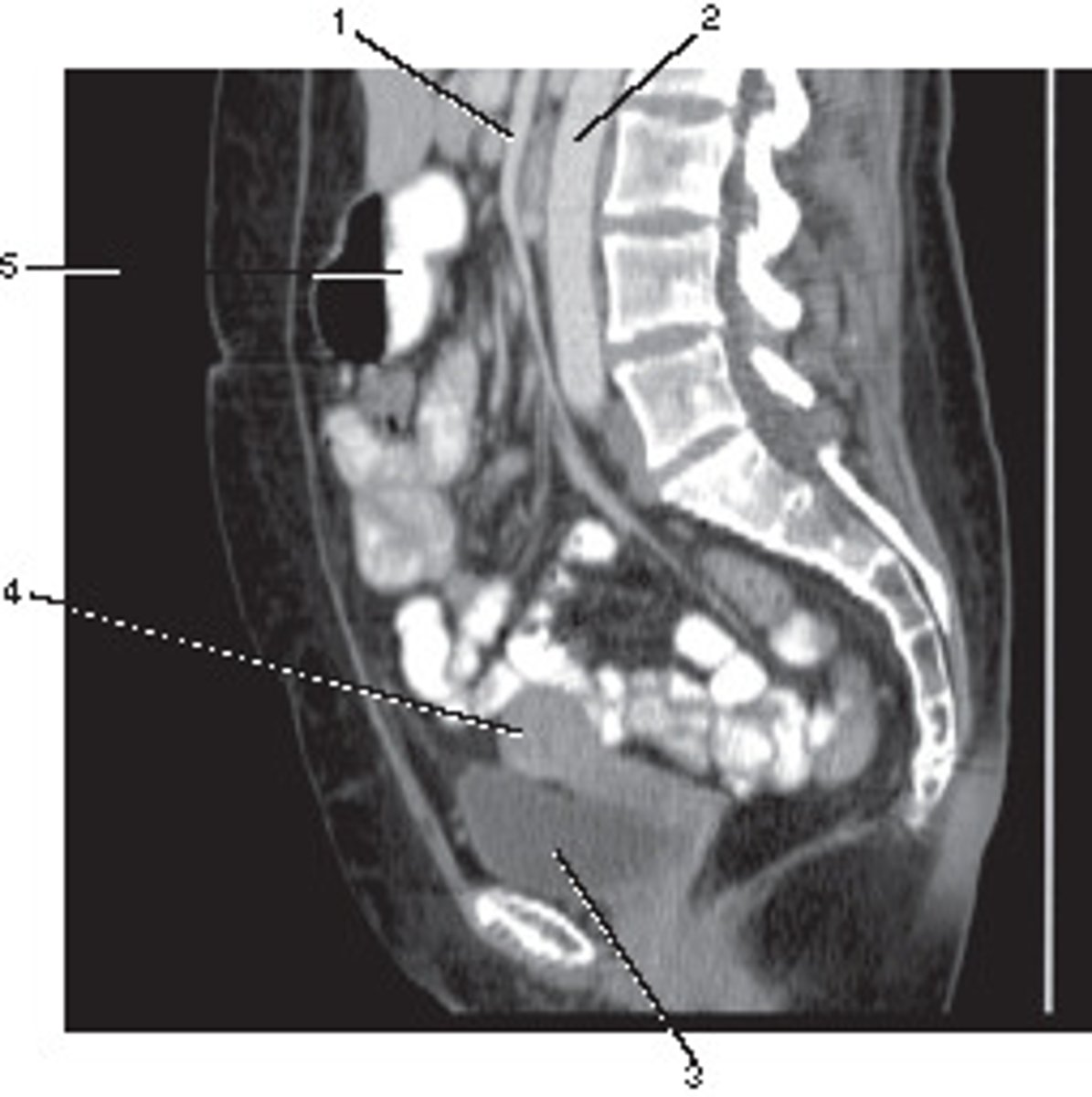 <p>What anatomic plane best describes this image</p>