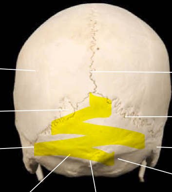 <p>Occipital bone</p>