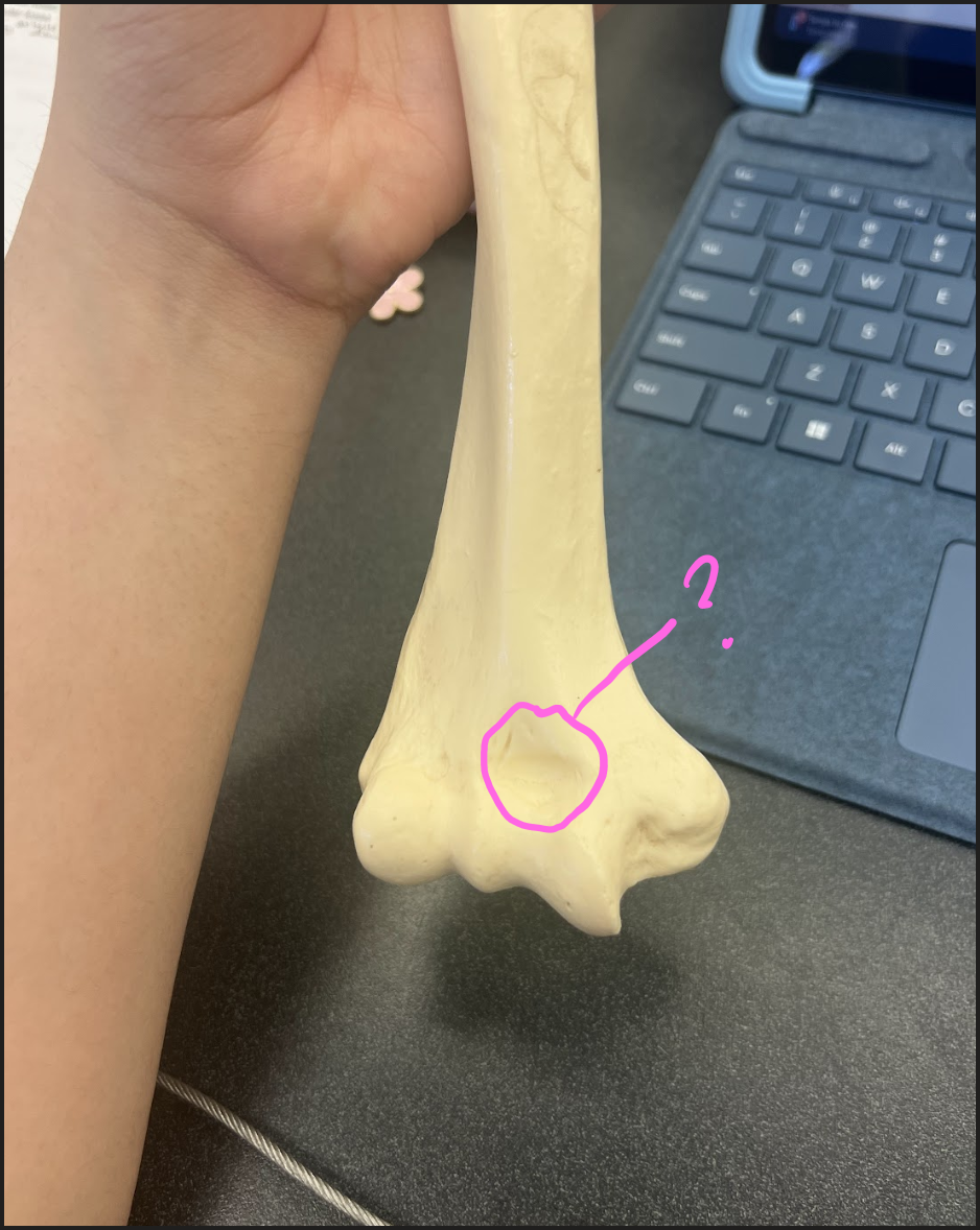 <p>What is this circled region? (little dent)</p>