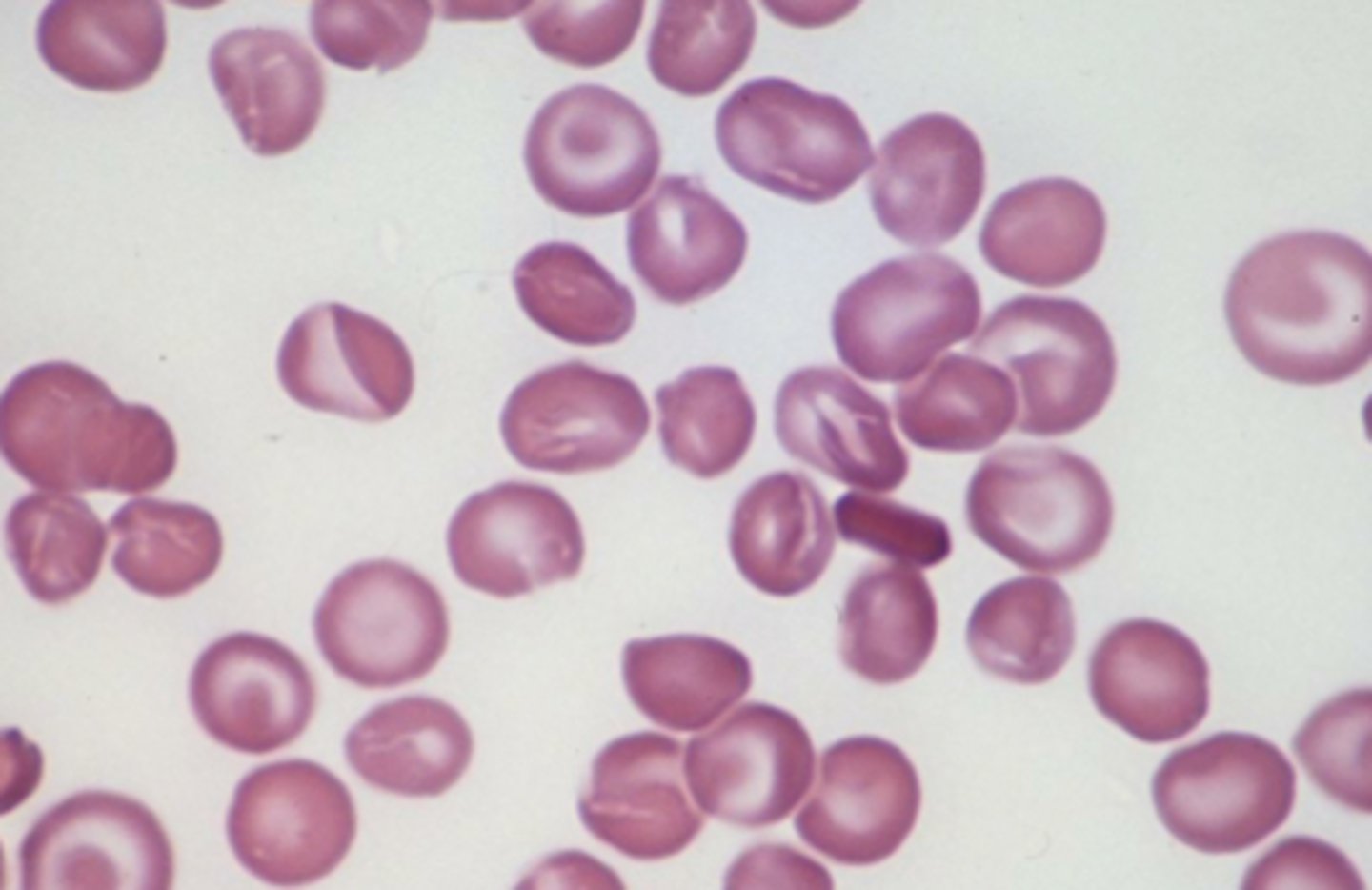 <p>- found in red blood cells, it transports oxygen</p><p>- oxygen binds to iron giving it a bright orange-red color</p><p>- affects skin color in areas of increased blood flow</p>