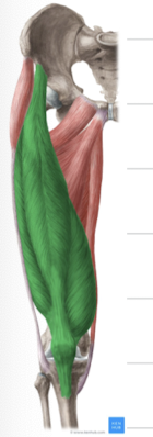 <p>Identify this muscle?</p>