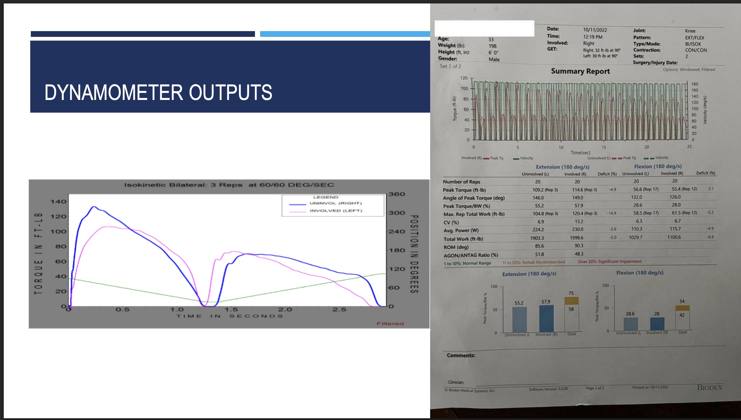 <p>-Patient setup: Secure the patient in a seated position on the isokinetic dynamometer. Use stabilizing straps across the chest, hips, and thigh to isolate movement to the knee joint. Align the machine's axis of rotation with the lateral epicondyle of the knee.</p><p>-Familiarization and warm-up: Before the test, have the patient perform several submaximal and then a few maximal practice repetitions to minimize learning effects and familiarize them with the equipment and protocol.</p><p>-Testing: </p><ul><li><p>Set the dynamometer to the desired velocity.</p></li><li><p>Instruct the patient to perform 15-20 consecutive, maximal-effort knee extensions.</p></li><li><p>Provide standardized verbal encouragement (e.g., "Push as hard and as fast as you can") to motivate a maximal effort on every repetition.</p></li></ul><p>-Data collection: The dynamometer records various metrics for each repetition, including:</p><ul><li><p>Peak torque: The maximum force produced during a single repetition.</p></li><li><p>Total work: The force generated over the entire range of motion, providing a more comprehensive measure of performance.</p></li><li><p>Power: The rate at which work is performed.</p></li></ul><p><u>Graph</u></p><p>-loose torque when doing extension</p>
