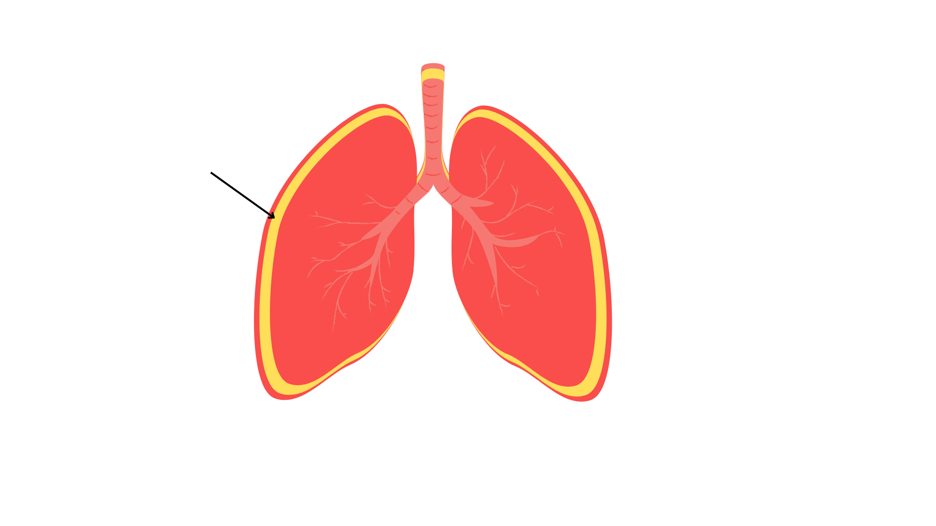 <p>Pleural Cavity</p>