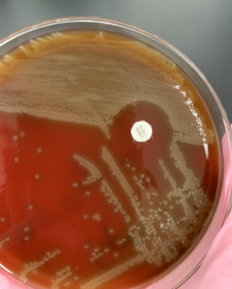 <p>if bile solubility is (+) meaning the colonies lyse what organism is this</p>