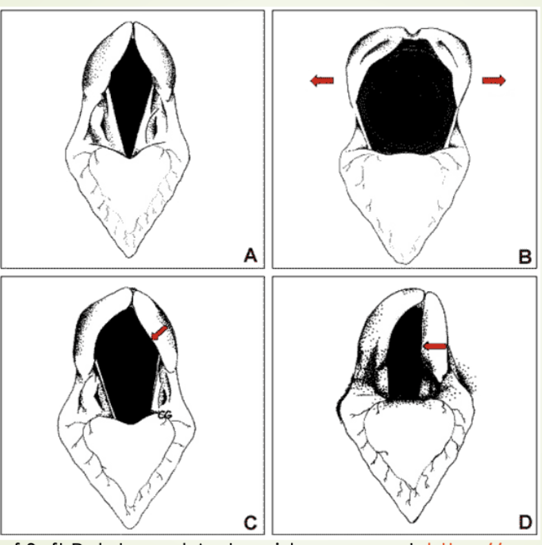 What is image C picturing?