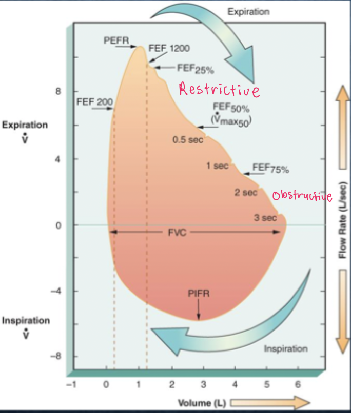 <p>• graphic presentation of FVC maneuver followed by forced inspiratory vol (FIV) maneuver</p><p></p><p>• smooth, bell-shaped loop, with a symmetrical inspiratory limb and a linear, convex expiratory limb</p><p></p><p>•&nbsp;<span>absence of significant airflow obstruction or restriction</span></p>