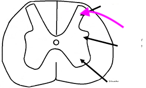 <p>What is this feature? is it S or M?</p>