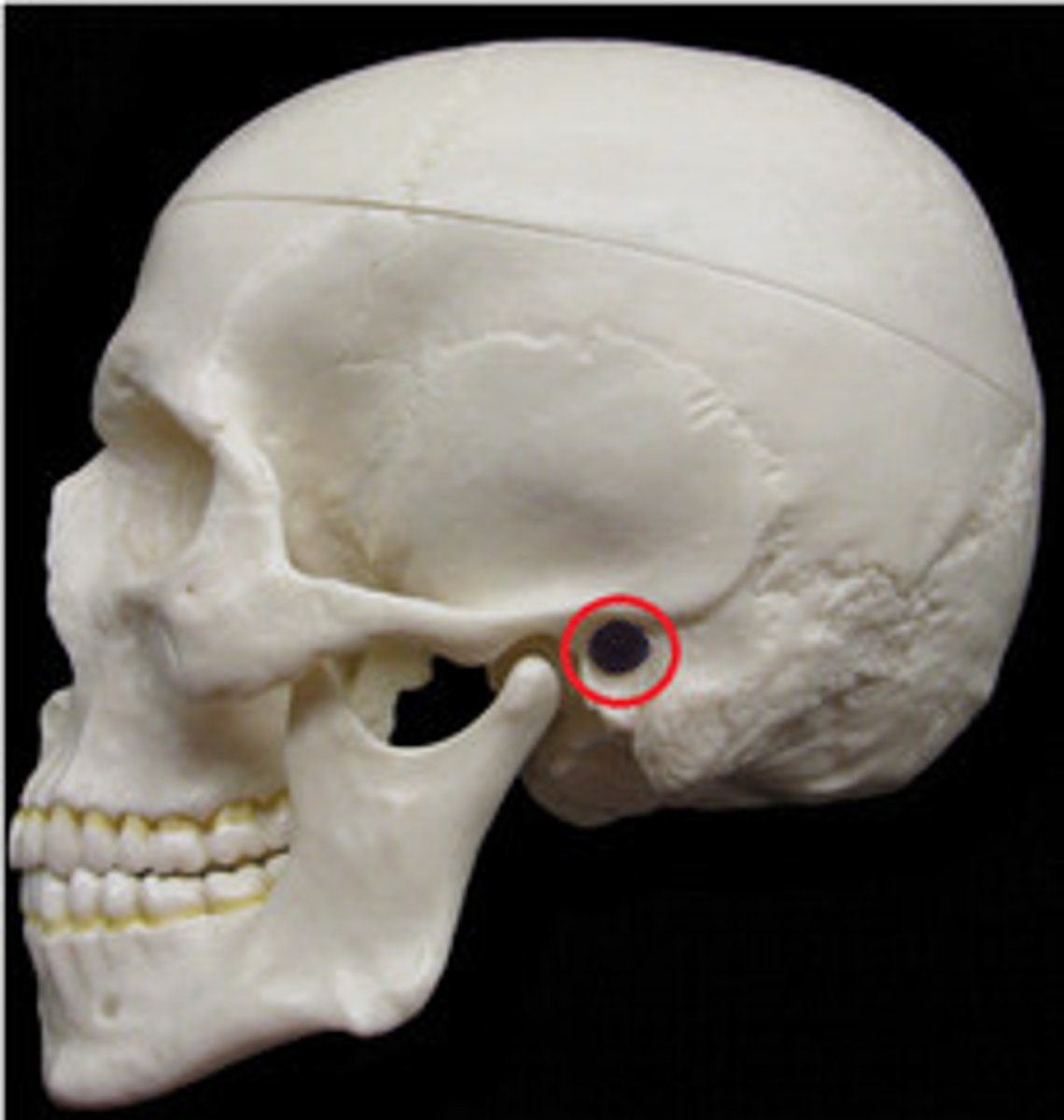 <p>outer ear canal</p>