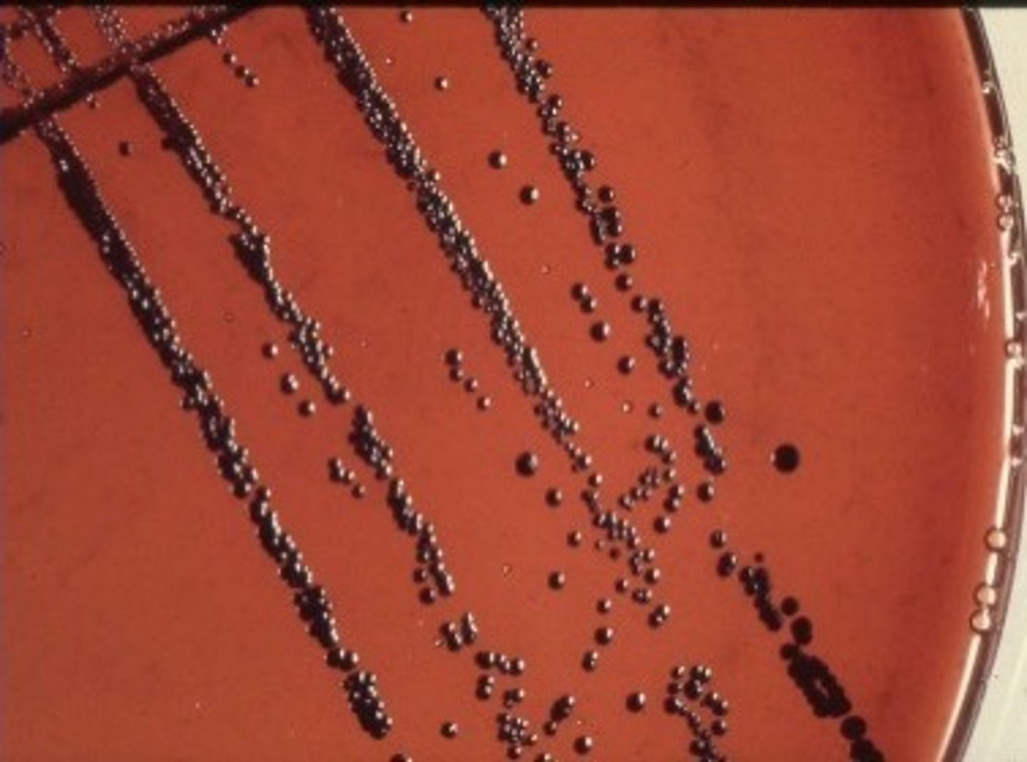 <p>Selective and differential for Corynebacterium diphtheria.</p>