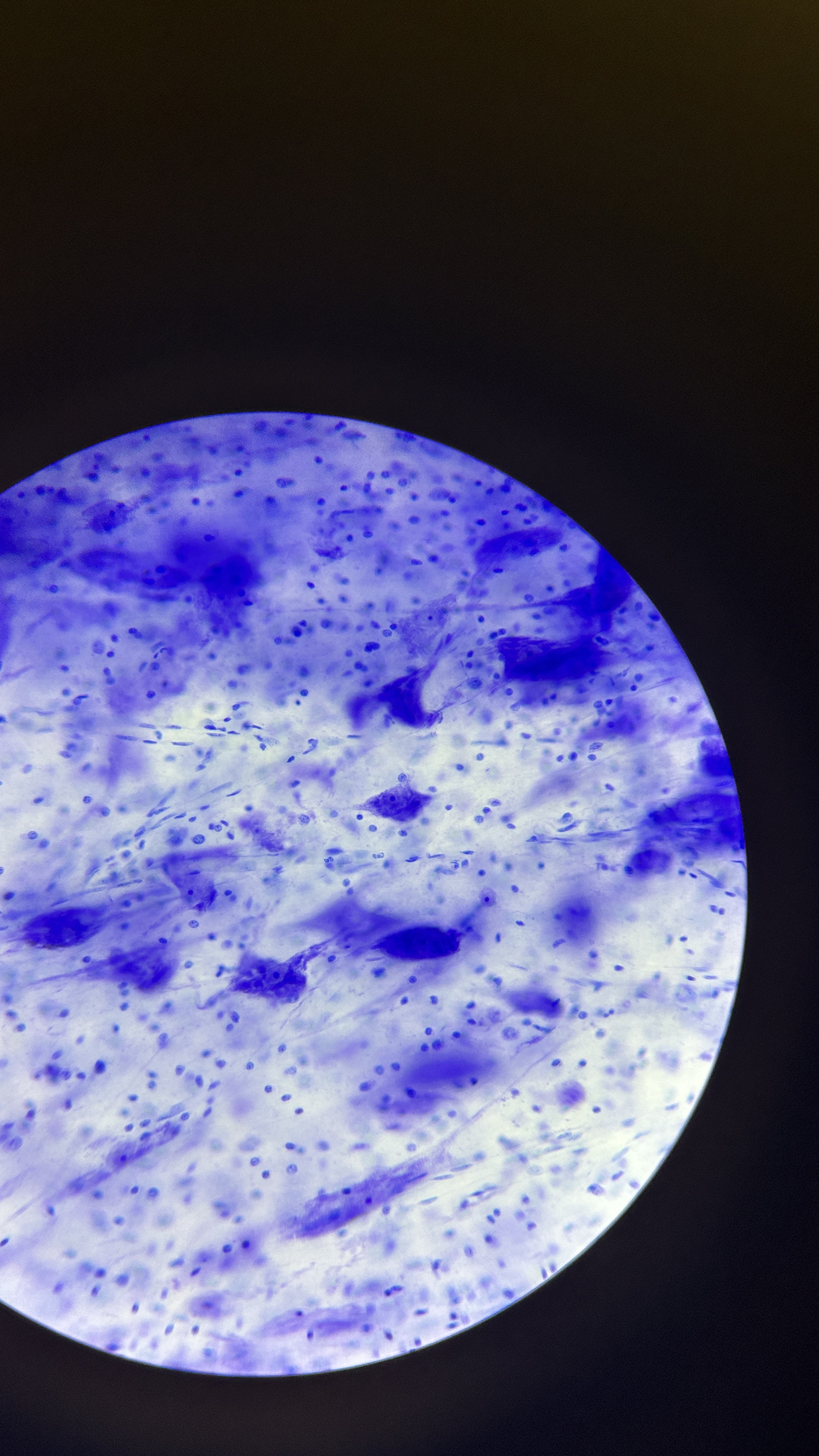 <p>What is the magnification level of the Nervous Tissue?</p>