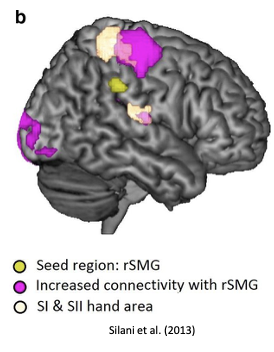 <p>Low-frequency repetitive transcranial magnetic stimulation (i.e., disruption) of rSMG increased emotional egocentricity - thinking more about yourself than other people</p>