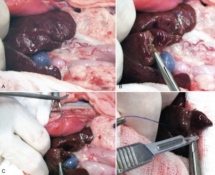 <p>- Crush a region and place a suture around it (monofilament, PDS)</p><p>- Best for peripheral or generalized lesions</p>