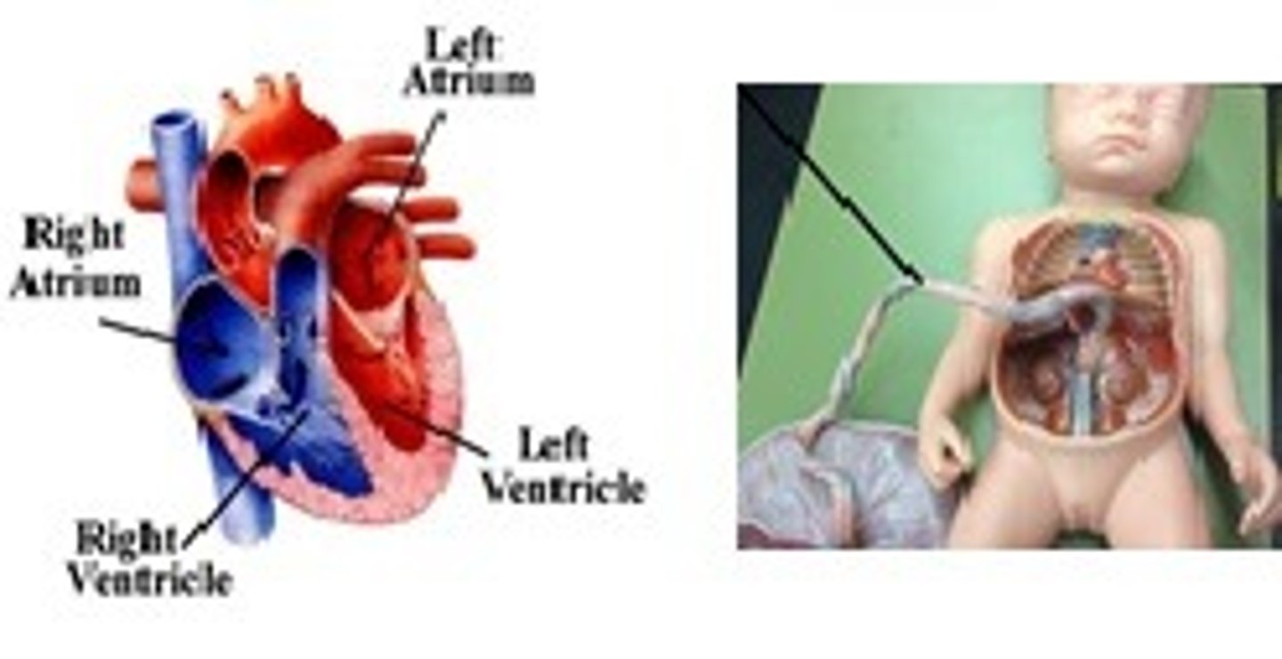 <p>(i) heart: (ii) cord</p>