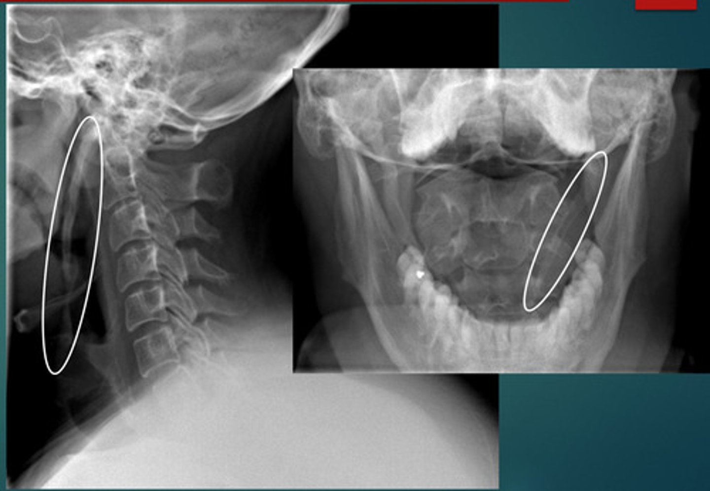 <p>What abnormality are we looking at?</p>