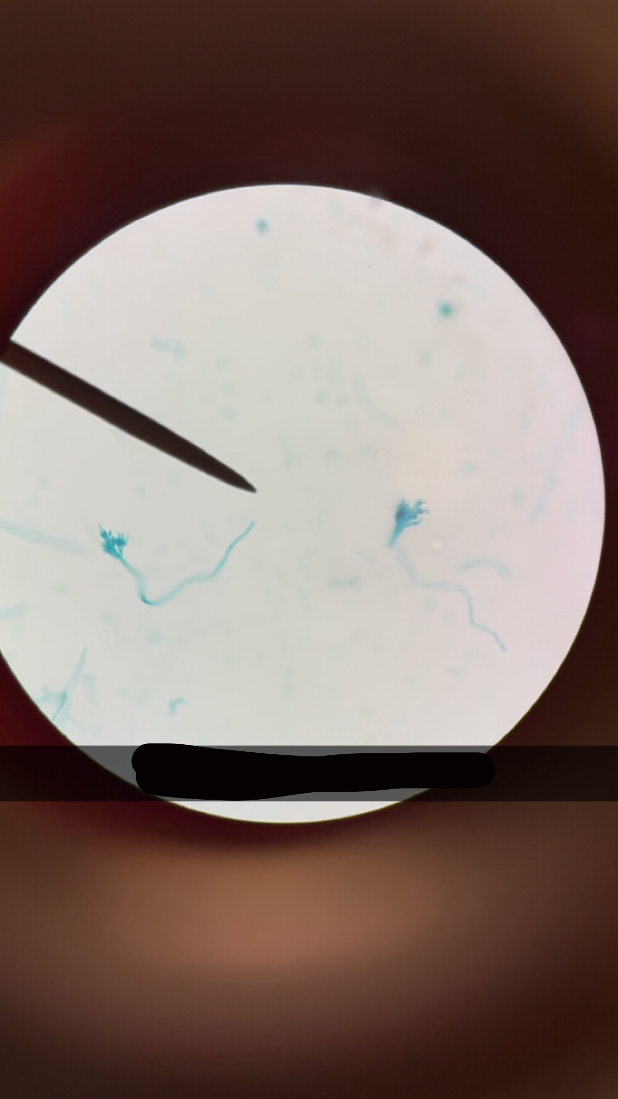 <p>What’s the name of this </p>