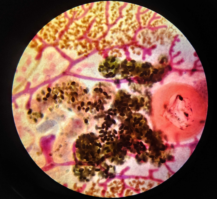 <p><span data-name="microscope" data-type="emoji">🔬</span><span data-name="petri_dish" data-type="emoji">🧫</span><strong><span> </span>Na podstawie zdjęcia preparatu:</strong></p><p></p><ul><li><p><span data-name="book" data-type="emoji">📖</span><span> </span>rozpoznaj gatunek pasożyta;</p></li></ul><p></p><ul><li><p><span data-name="recycle" data-type="emoji">♻</span><span> </span>rozpoznaj wszystkie formy rozwojowe;</p></li></ul><p></p><ul><li><p><span data-name="microbe" data-type="emoji">🦠</span><span> </span>wskaż organelle i cechy charakterystyczne dla danego gatunku;</p></li></ul><p></p><ul><li><p><span data-name="mask" data-type="emoji">😷</span><span> </span>nazwij chorobę, którą pasożyt wywołuje.</p></li></ul><p></p>