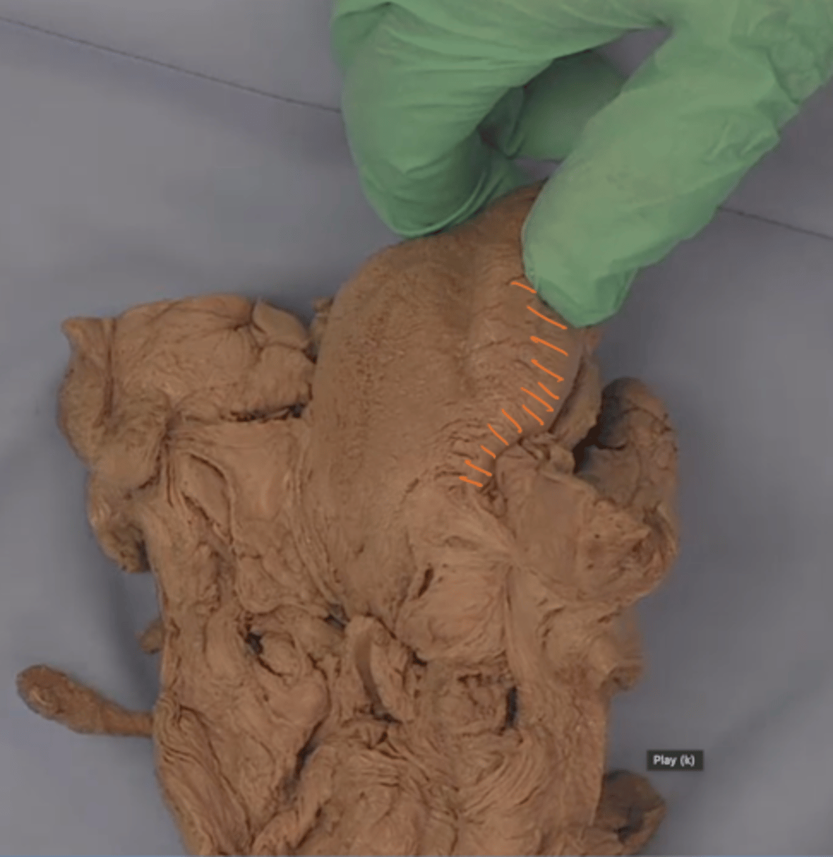 <p>identify structures in orange</p>