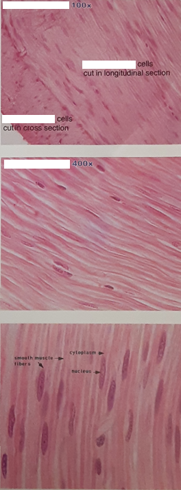 <ul><li><p>Visceral: found in the walls of hollow organs</p><ul><li><p>Blood vessels, Stomach, Respiratory Passages, Urinary bladder, ect.</p></li></ul></li><li><p>spindle shaped cells</p></li><li><p>Non-striated appearance</p></li><li><p>Single nucleus</p></li><li><p>involuntary muscle</p></li><li><p>stimulated by ANS, Hormones and changes in ion levels</p></li></ul><p></p>