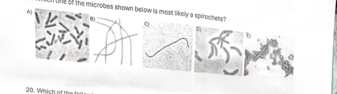 <p><span>Which one of the microbes shown below is most likely a spirochete?</span></p>