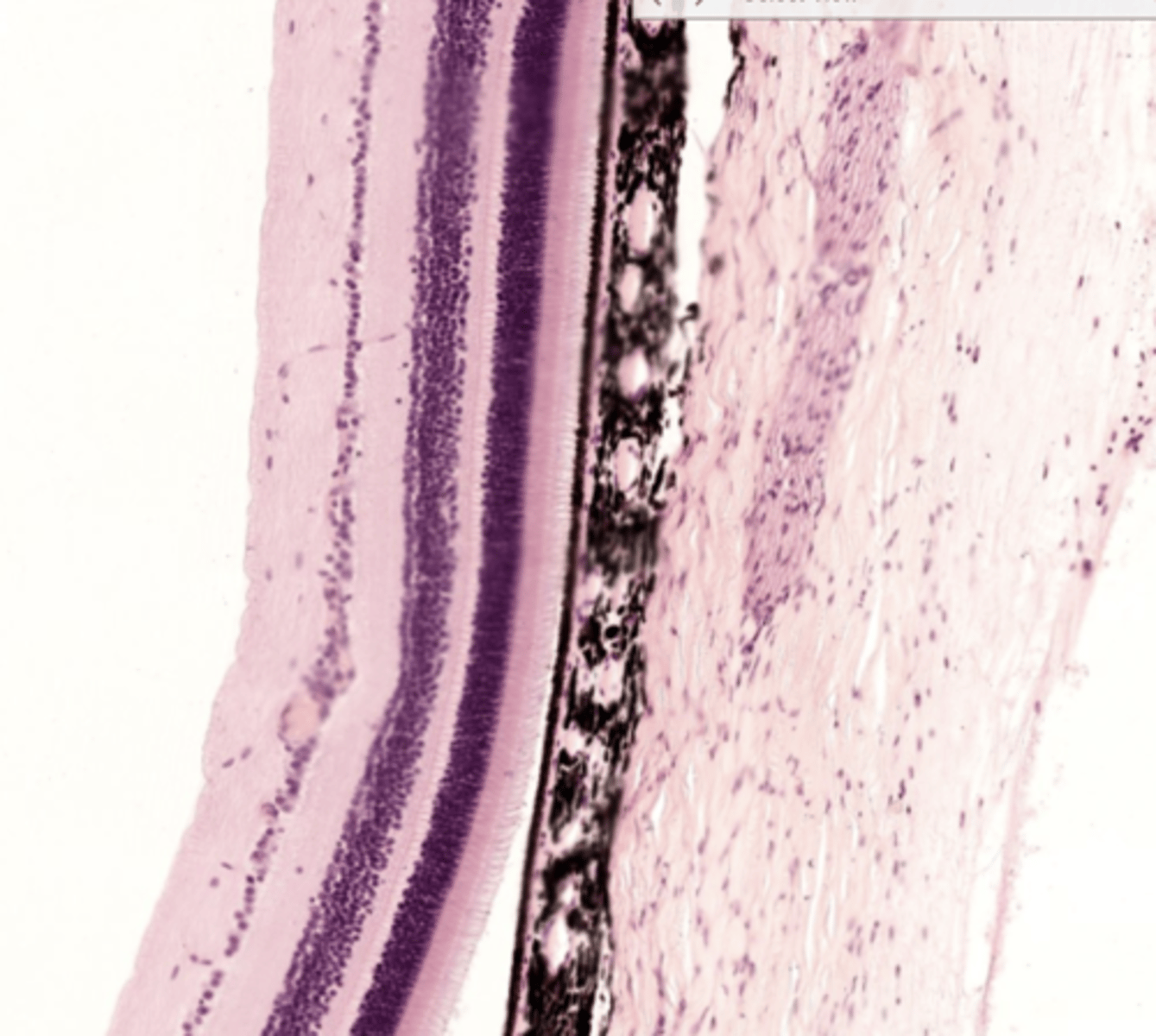 <p>To the left of the black band</p>