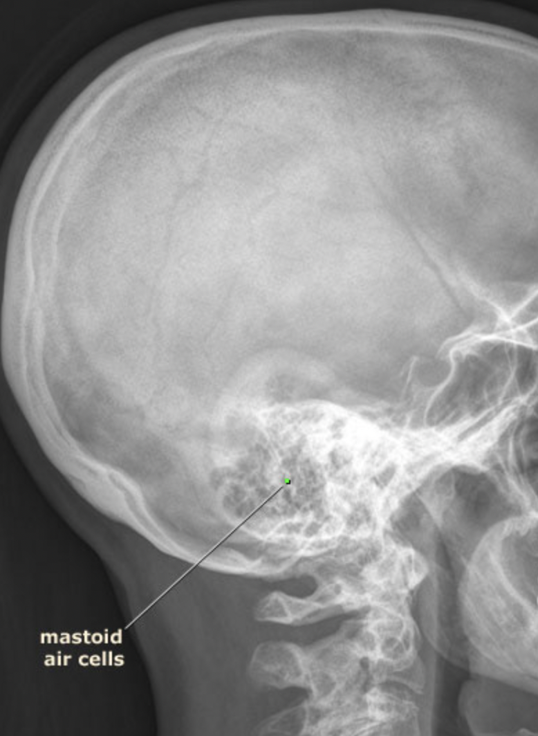 <p>Structures that lighten the skull and help resonate sound.</p>