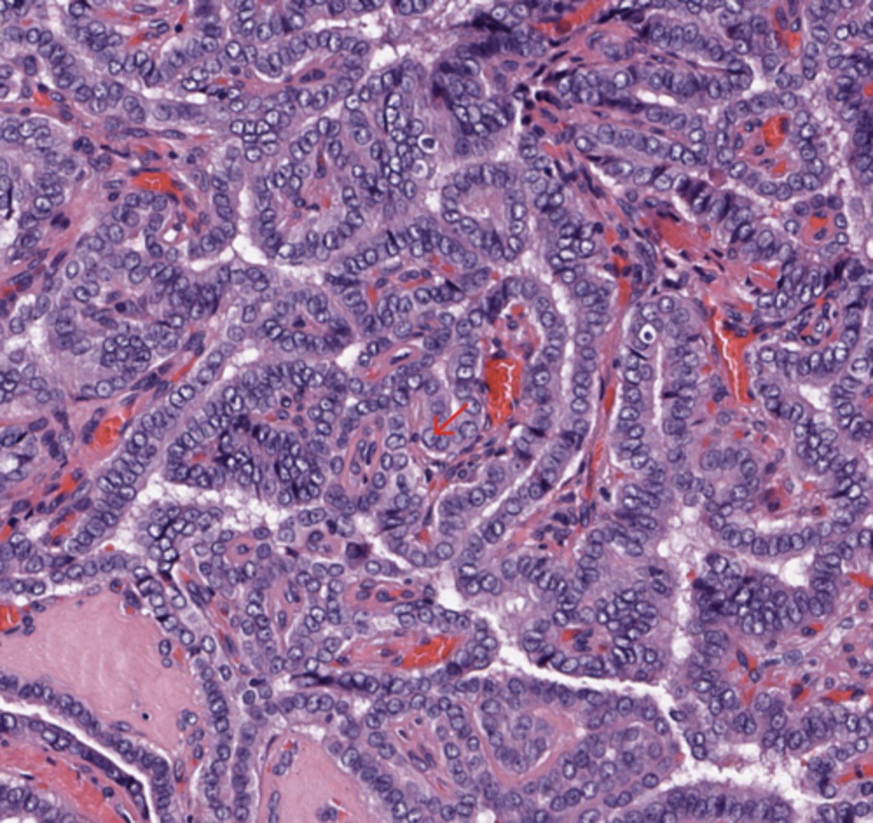 <p>Thyroid</p>