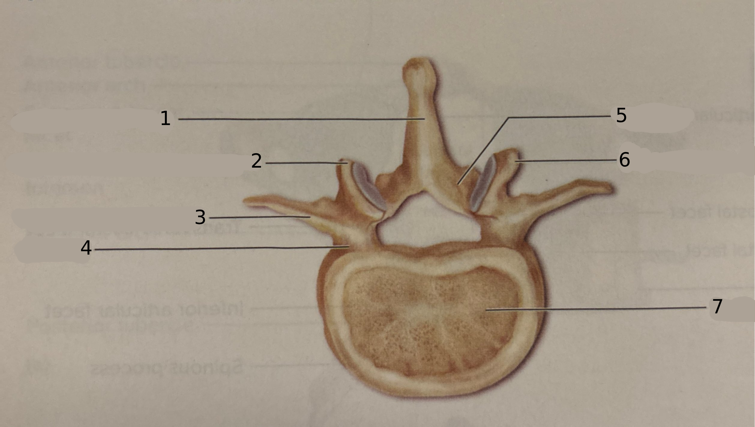 <p>What type of vertebra is this?</p>