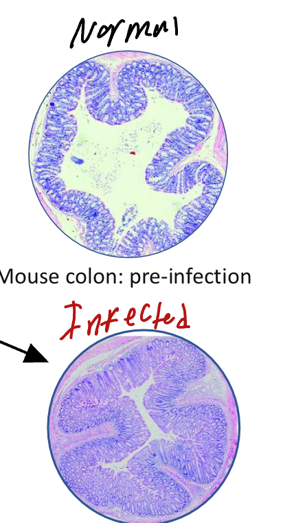 <ul><li><p>Murine Colonic Hyperplasia (Image)</p></li><li><p>C.S</p><ul><li><p>Diarrhea, rectal prolapse</p></li><li><p>Effacement of the brush-border&nbsp;</p></li></ul></li></ul><p></p>