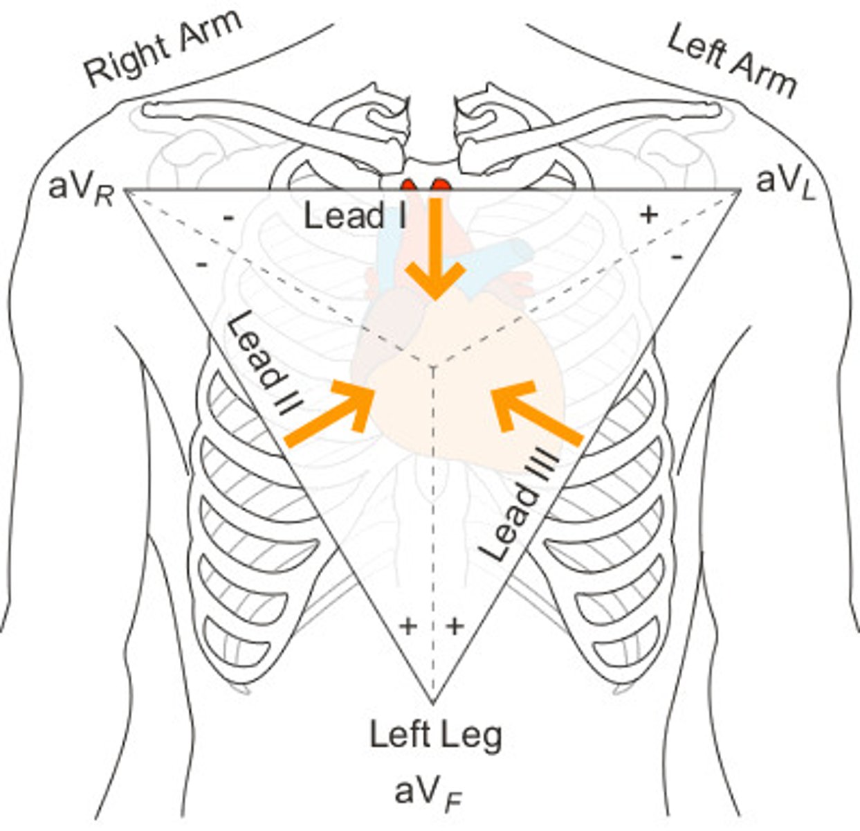 <p>Leads I, II, and III</p>