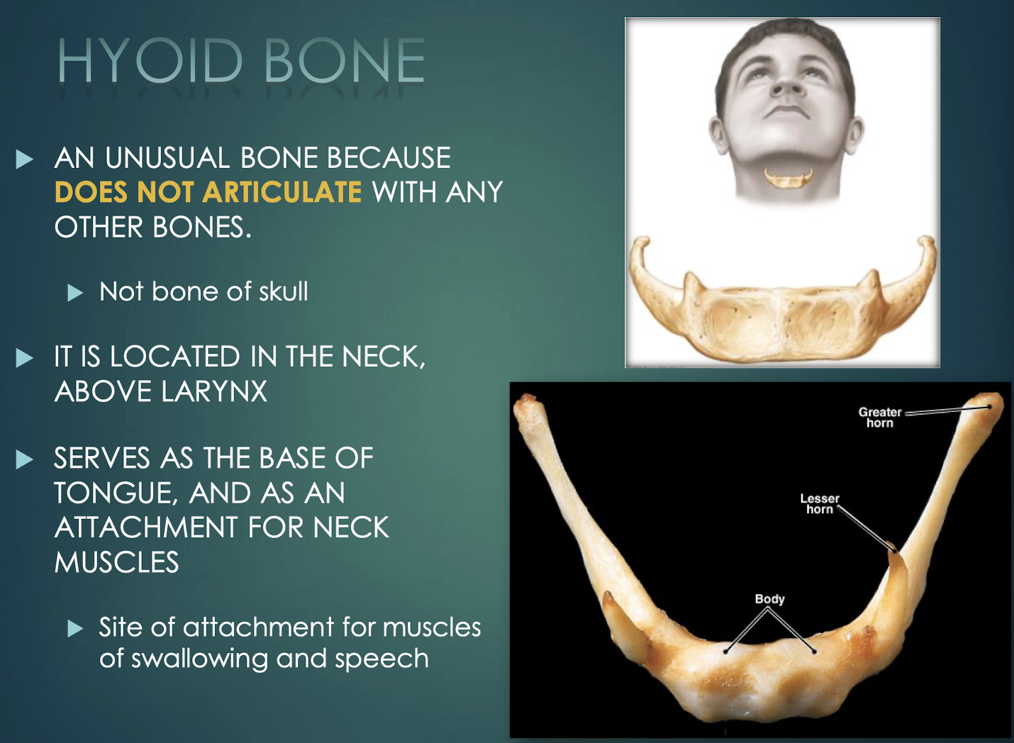 <p>Hyoid Bone</p>
