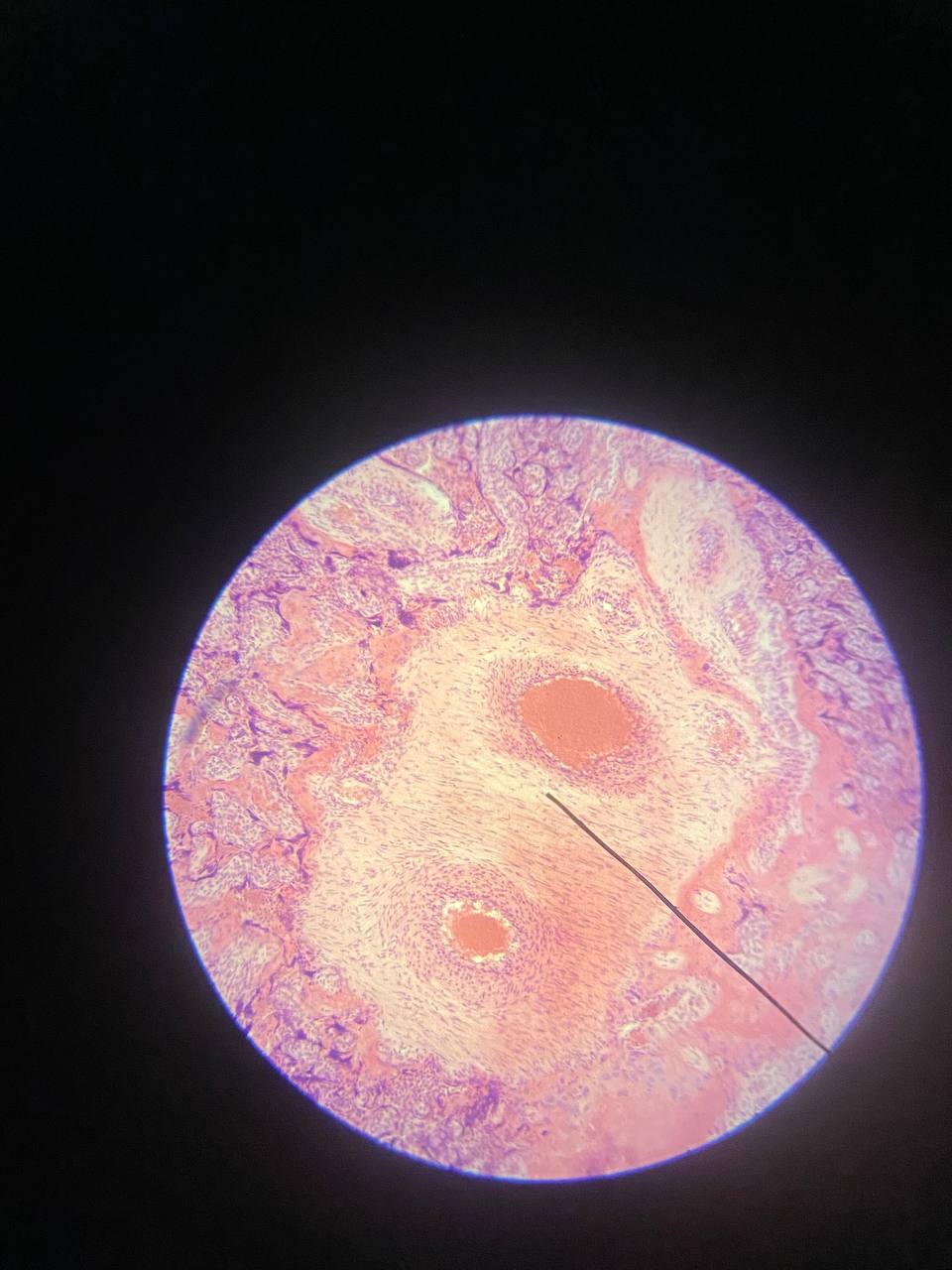 term image