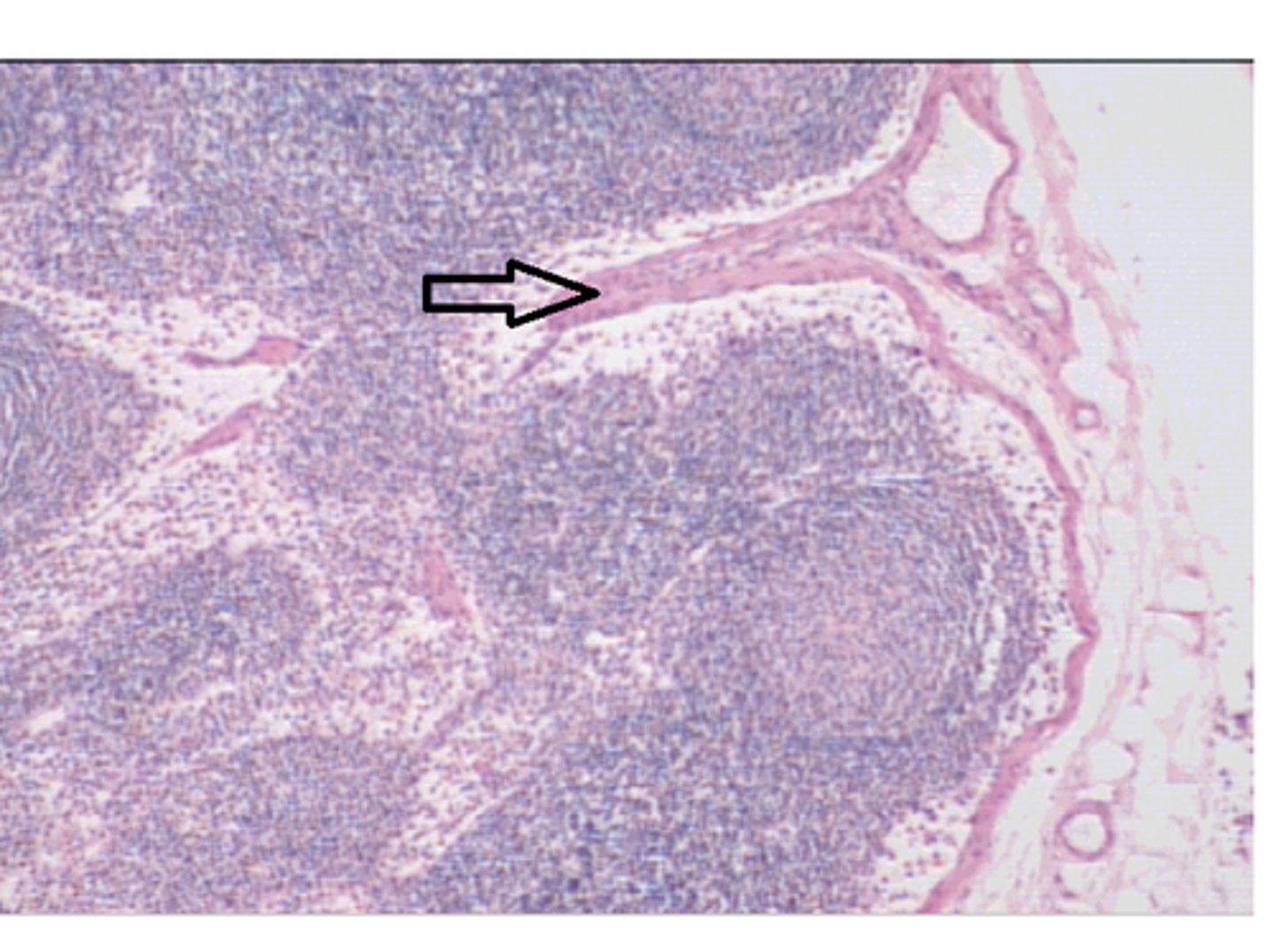<p>Identify the structure at the arrow?</p><p>Trabeculae of the lymph node</p>